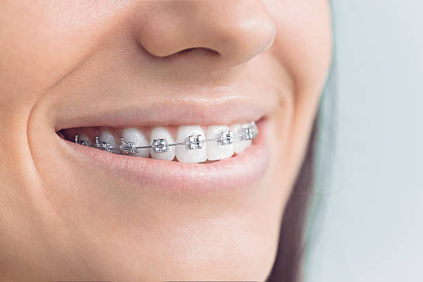 Best Wisdom Tooth Removal  in Jenison, MI